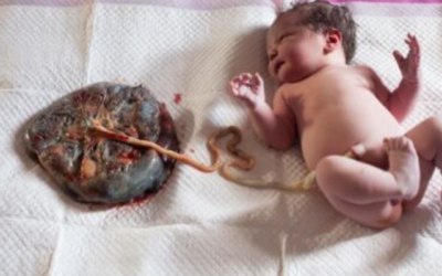Comer placenta? Eca! Que legal!